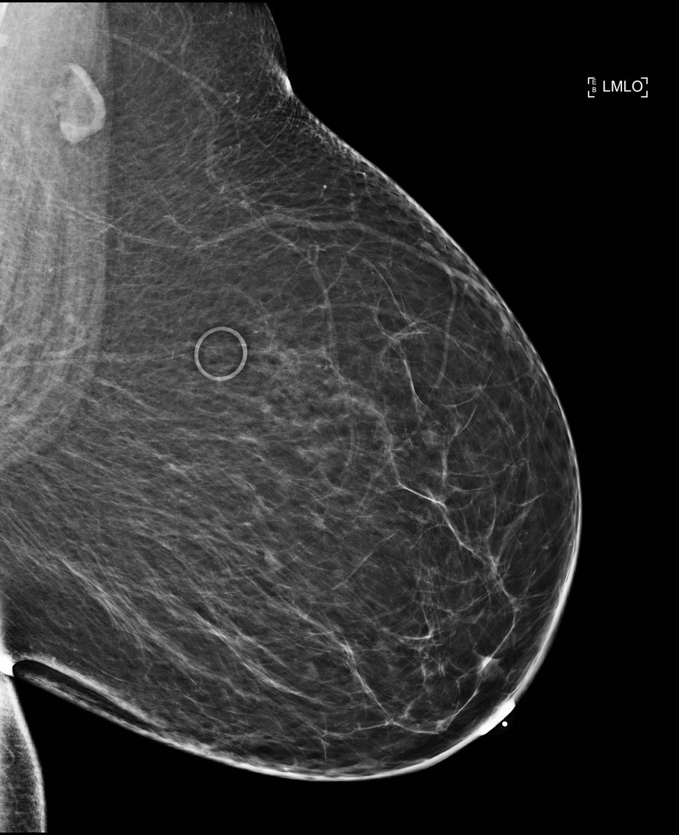 download Die akute normo—volämische Hämodilution in klinischer Anwendung