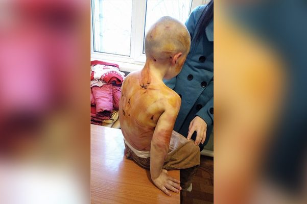 Vīrietis cietsirdīgi piekauj savas civilsievas meitiņu ar telefona lādētāju un siksnu (VIDEO) | dzentlmenis.lv/virietis-ciets…