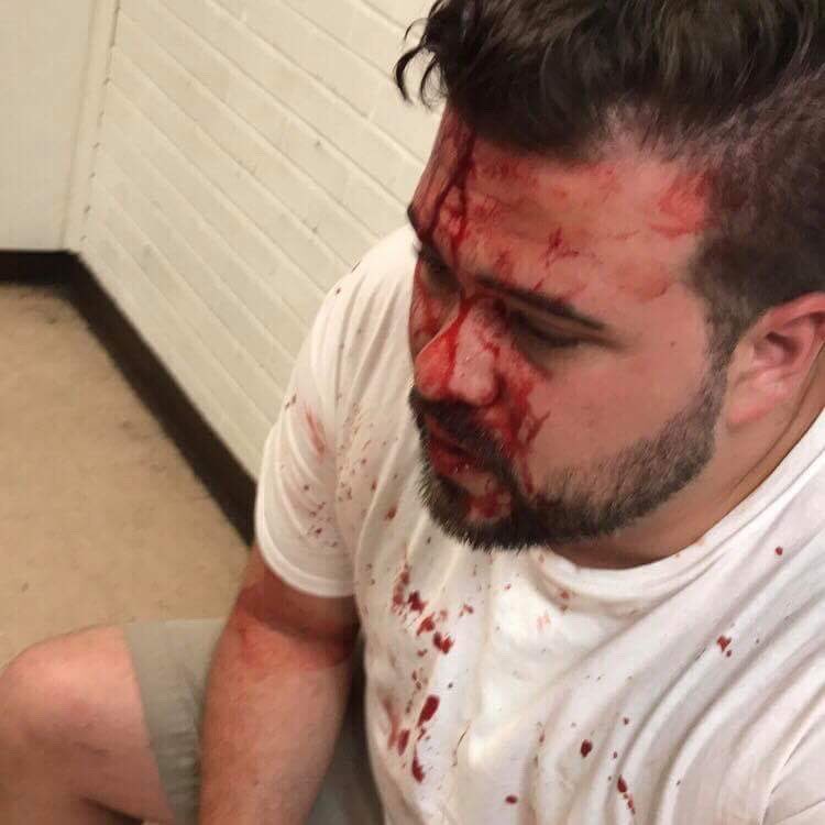 Brettastic1's tweet photo. I’ll never forget this, #MetalRiotGods... @EliteCWrestling #SummerFest tonight, @DirtyBlondesTag and I won’t leave anything left of you before the Bull Rope match on July 8th. @realjohnsaxon4 @ryanoshun @MRG_slaughter #EliteFL https://t.co/XZaeCJi9S0