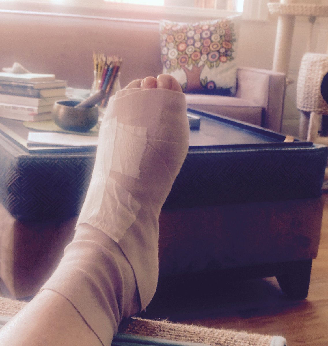 SandySherrill's tweet photo. My view for the next 12 days. Left medial subdermal #interloperectomy #imadethatup https://t.co/aK44BHCVYL