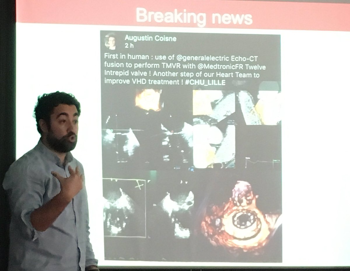 guilbon's tweet photo. @AugustinCoisne @generalelectric @MedtronicFR @CHU_Lille @medecine_Ulille @modine_thomas @arnaud_sudre @Eric_Van_Belle @Flavien_Vincent @univ_lille On parle de vous lors du week end jeunes fondamentalistes et jeunes cardiologues. #WECCFGRRC 👏 Magnifique avancée ! https://t.co/2hv1jwXPsO