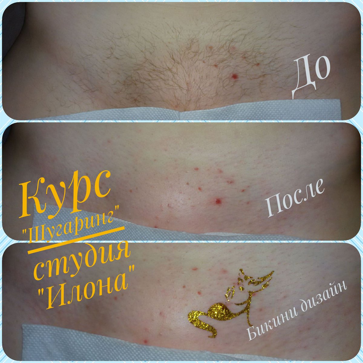 Шугаринг и тату