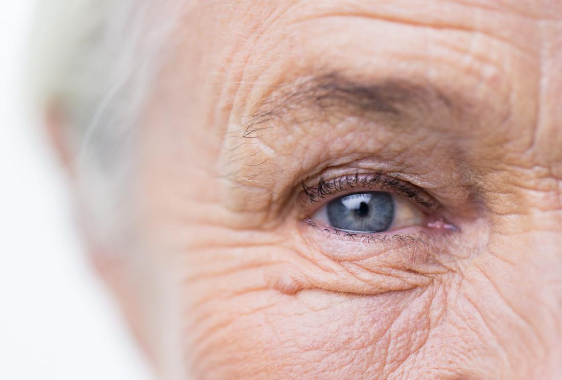 mnt's tweet photo. Do eye wrinkles make us appear more sincere? https://t.co/0S3AOUvfYN @mnt #facialperception #psychology https://t.co/CHSBd58tgu