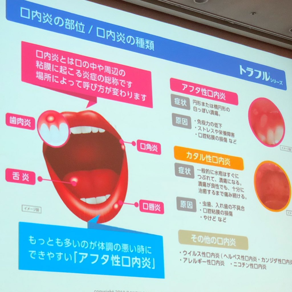momona🍑 on Twitter "口内炎にも種類があるんですね🤔 最近口内炎にはなってなかったので 豊富な
