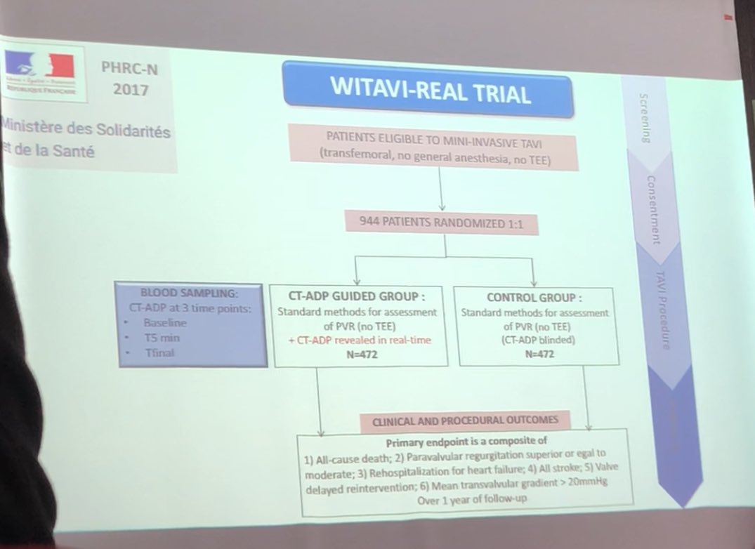 CCF_cardio's tweet photo. #WECCFGRRC Présentation sur les données sur le Willebrand dans le TAVI. Vers une place du PFA-100 permettant de monitorer le F. Willebrand directement en salle hybride. Annonce d un PHRC « WITAVI-REAL ». 👏 @Flavien_vincent CHU Lille https://t.co/0BwaaQc3iS