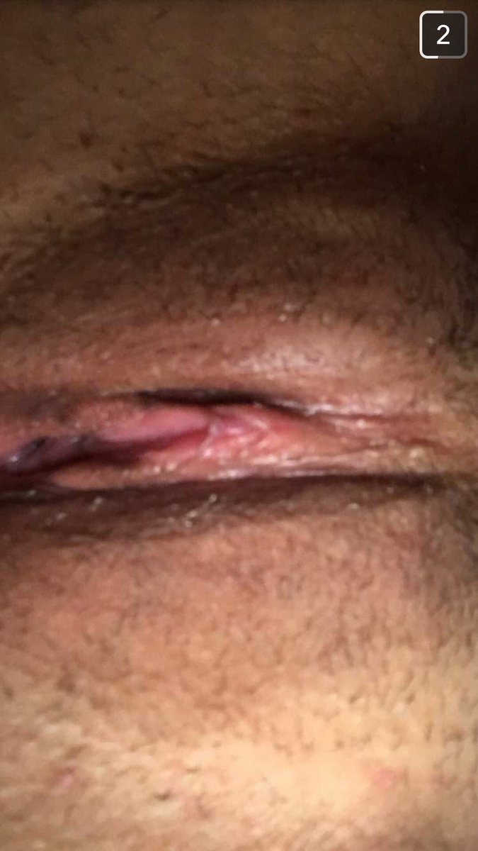 snapgroupchat's tweet photo. Add for nudes #sext #sexting #sextgroup #anal #pussy #cock #cunt #porn #fuck #cum #wetpussy #wet #dick #snapgroup #snapnudes #scnudes #daddy #ass #tits #tities #nipples #nipslipz #fuck #vagina #eatme #nudes #nude https://t.co/Sf8Oodj3uG