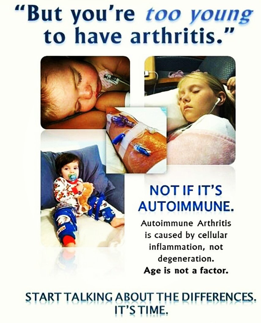 drsriazrheuma's tweet photo. KIDS &amp; ARTHRITIS
kids can get a kind of arthritis called juvenile idiopathic arthritis.
Juvenile means young, so this means that JIA is different from the arthritis that adults get.
#arthritisawarness
#juvenileidiopathicarthritis
#automimmune #jointpain#sickchild #jointswelling https://t.co/G2ZqT4W7Qi