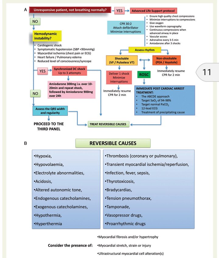 renecardio4's tweet image. Manejo de Taquiarritmias en cuidado critico y post cirugia #ESCguideline2018 #cardiotips @escardio
