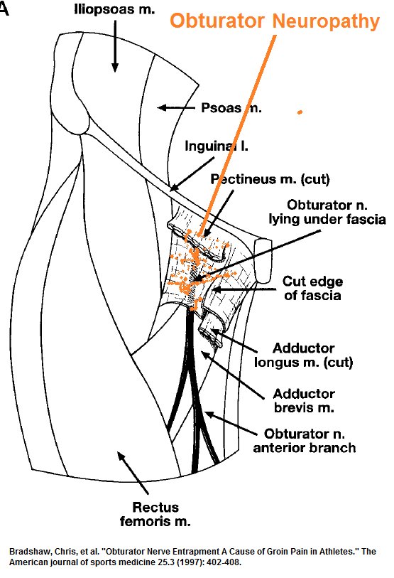 Groin Nerve Pain Overview And Treatment Options atelieryuwa.ciao.jp