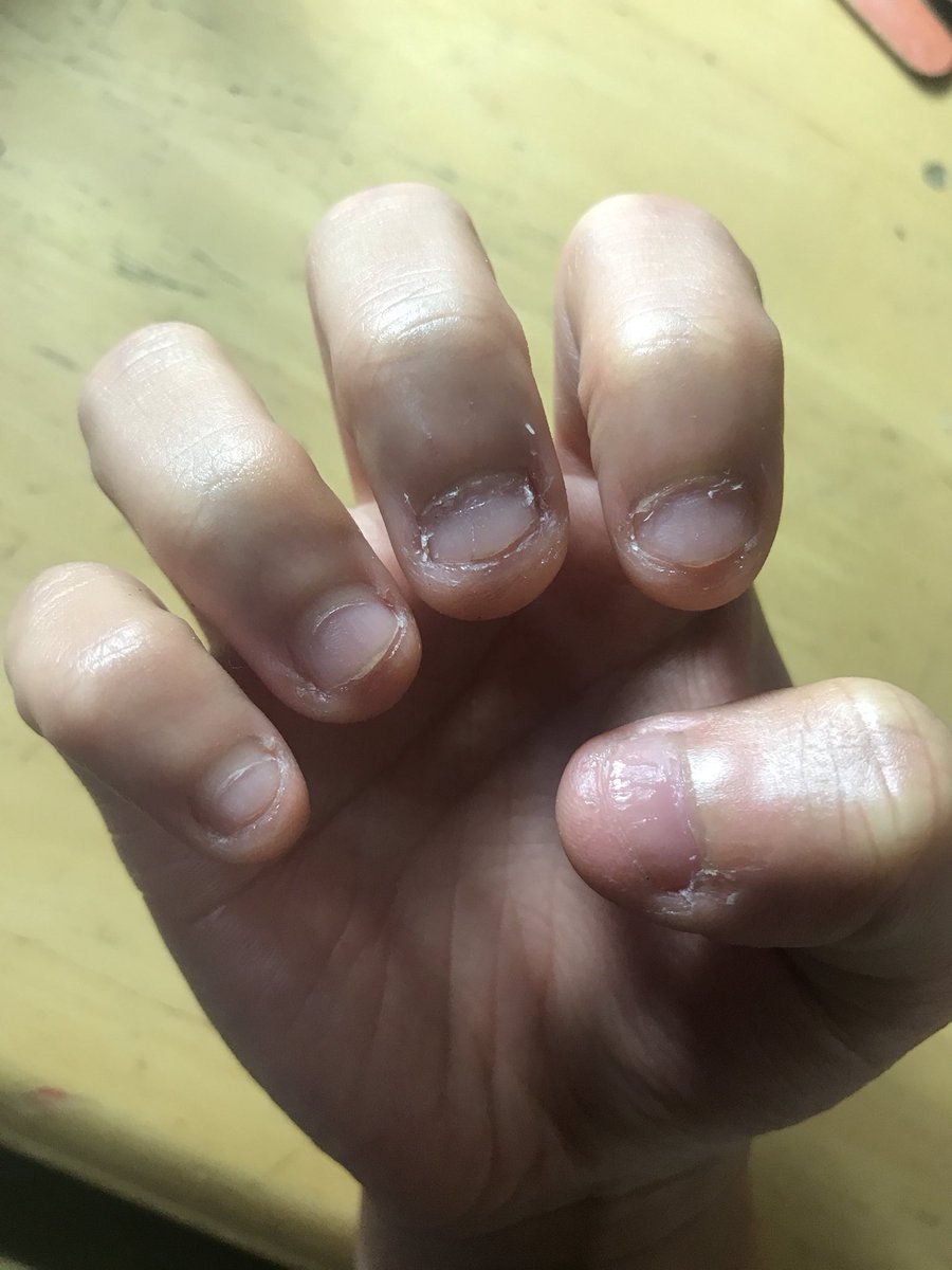 みかん 久しぶりの更新 白い部分あいかわらず多いけどだんだんピンクも多くなってきた 1枚目 3月26日 2枚目 今日