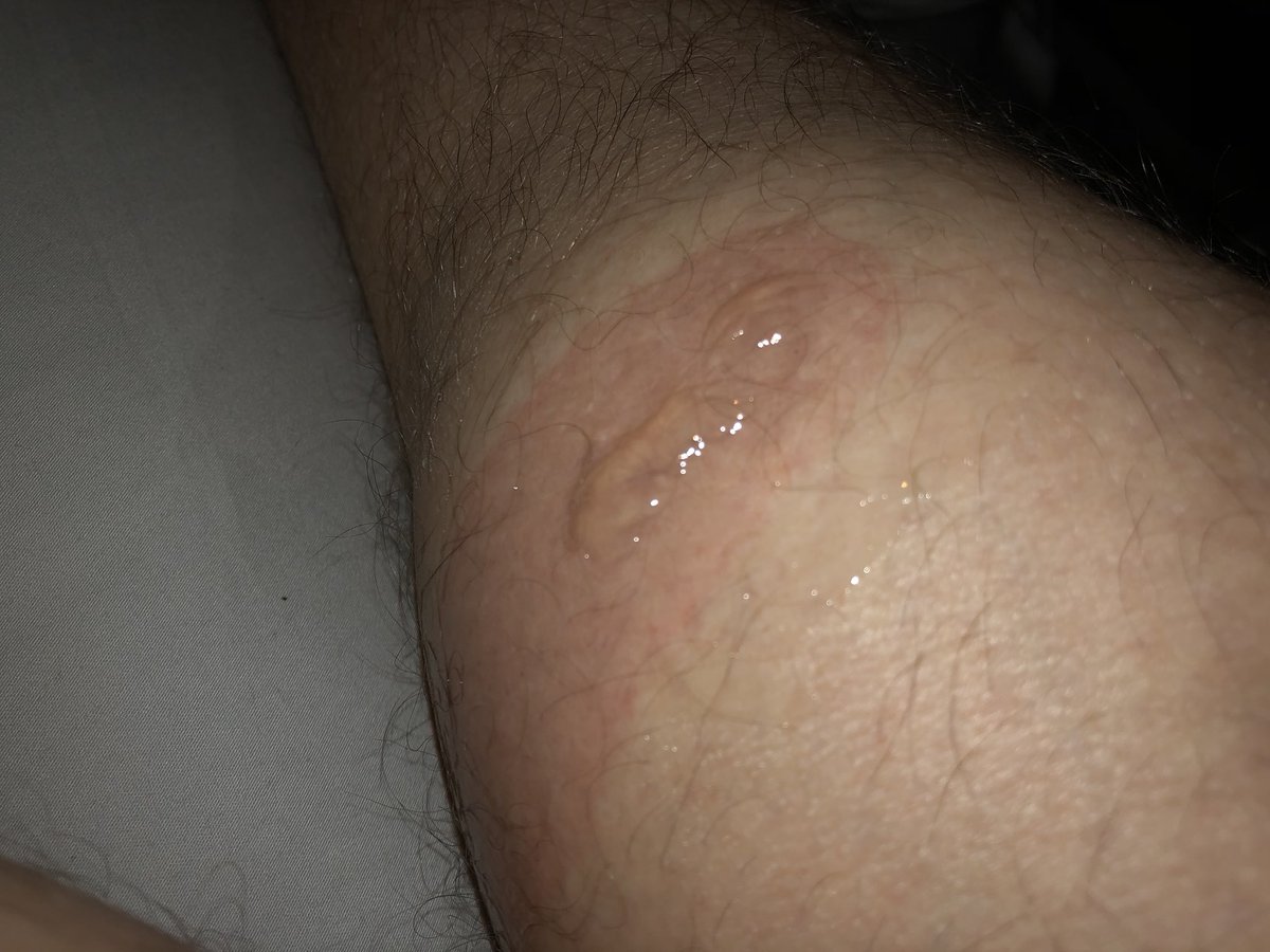 Bob on Bikes tweet media