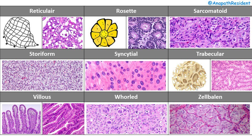 A_Morini_MD's tweet photo. Memo of different architecture patterns in pathology
#patternsinhistopathology #pathboards
@VijayPatho @BinXu16 https://t.co/T7DwIrybKN
