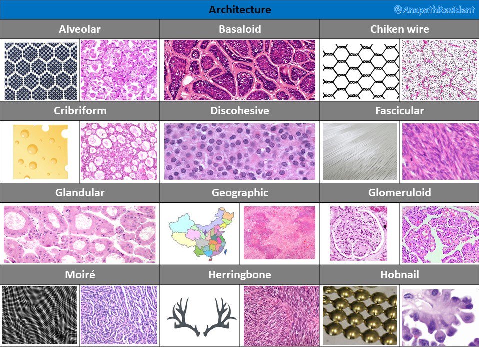 A_Morini_MD's tweet photo. Memo of different architecture patterns in pathology
#patternsinhistopathology #pathboards
@VijayPatho @BinXu16 https://t.co/T7DwIrybKN