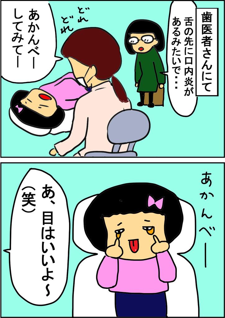 あかんべー