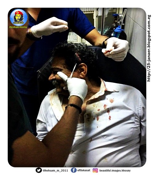 بالصور اصابة  فريد زهران بعد ان اعتدى   بلطجية على إفطار "الحركة المدنية الديمقراطية" بالنادي السويسري