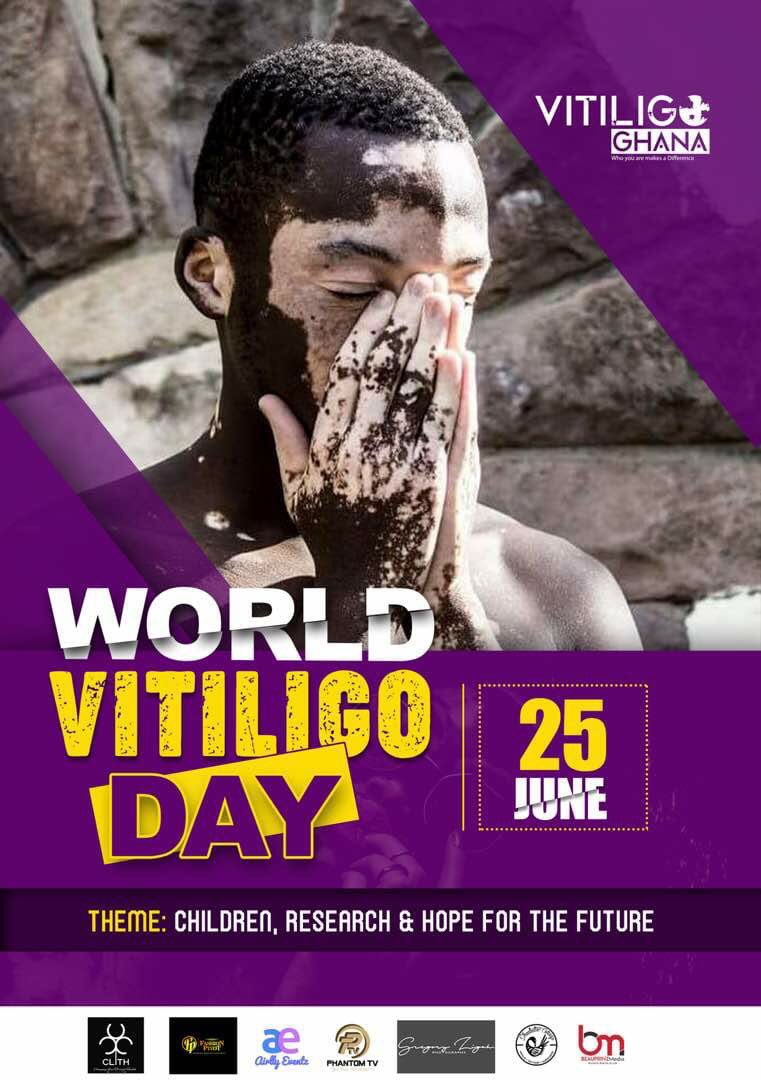 telikemeugene's tweet photo. Next project! @clith_ngo @airlly_eventz @VitiligoUK @TimepieceGh #CNA #PhantomMultimedia #RAMfoundation #GregoryZigahPhotography #Fasionpivot #BeauPrinceMedia #SheaButterCottage #VitiligoGhana https://t.co/hH23zPuaOq