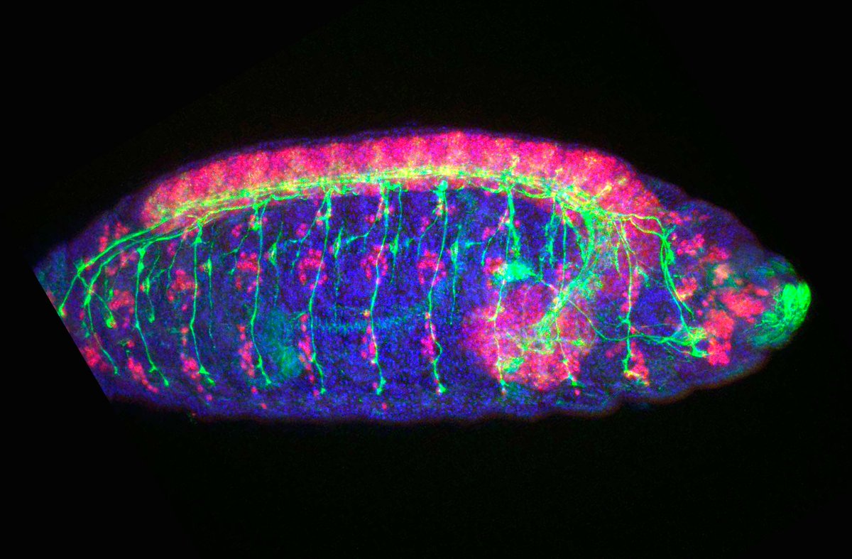 the Node (@the_node) on Twitter photo We have a winner for our <a href="/Dev_journal/">Development</a> cover competition!
With precisely 800 votes cast, Soraya Villaseca's beautiful #Drosophila embryo sits atop the podium! Congratulations Soraya #devbio #sciart ππ¬π We have a winner for our <a href="/Dev_journal/">Development</a> cover competition!
With precisely 800 votes cast, Soraya Villaseca's beautiful #Drosophila embryo sits atop the podium! Congratulations Soraya #devbio #sciart ππ¬π