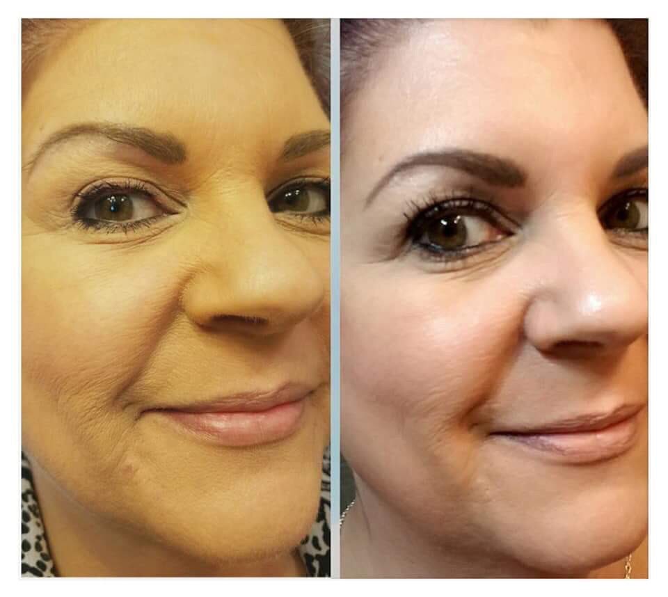DamTheButterfly's tweet photo. Here are a few before and after pictures of Betty, a Fellow #ThyroidDisease Warrior. Read her incredible success story with a new Program we're using for us Autoimmune Disease sufferers! 💪🏻🦋

Link to Betty's story - https://t.co/CFfwCV9aDN

 #thereishope #autoimmunedisease https://t.co/LS6Gt8Dntq