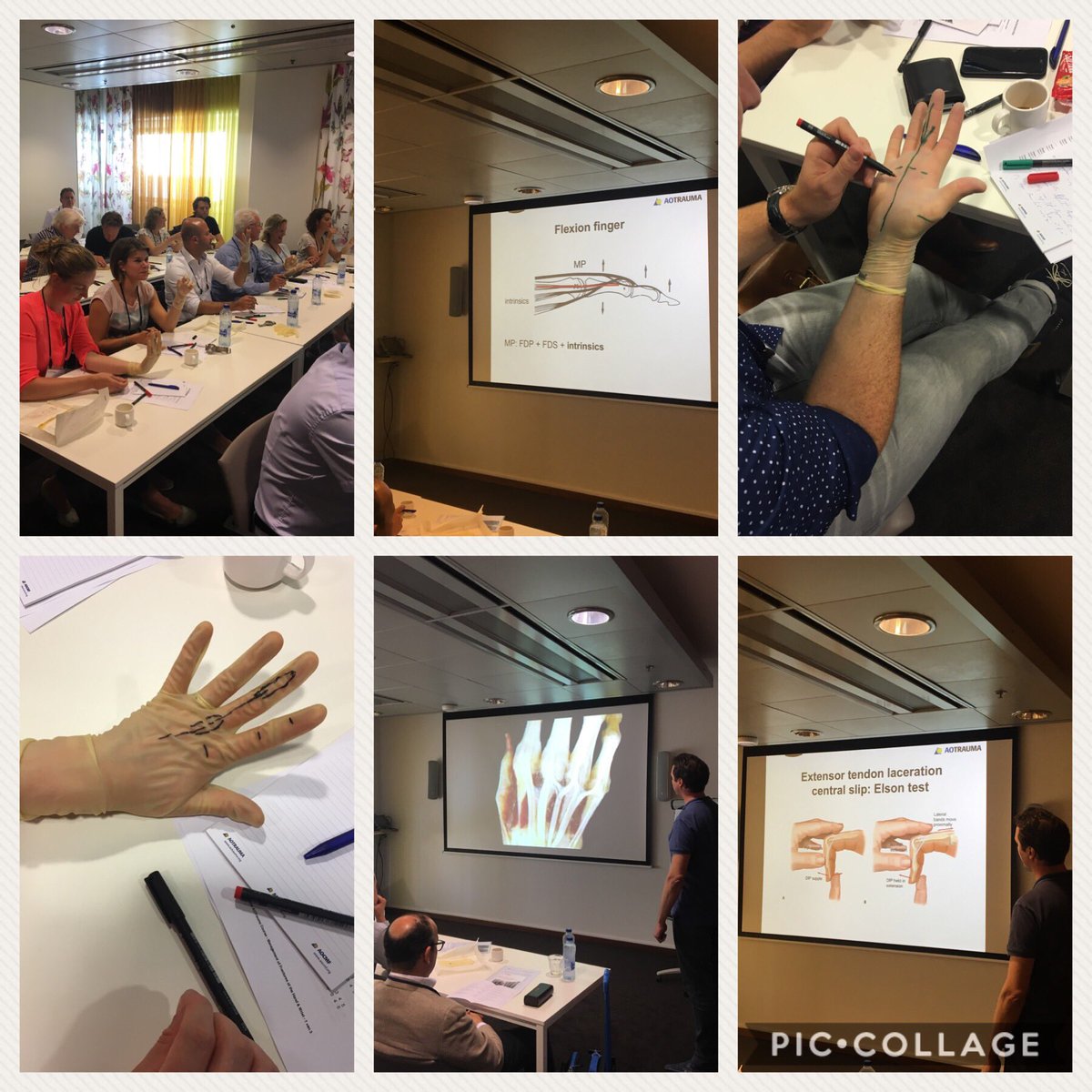 Lecture over de chirurgische anatomie van de hand #aonederland #aotrauma