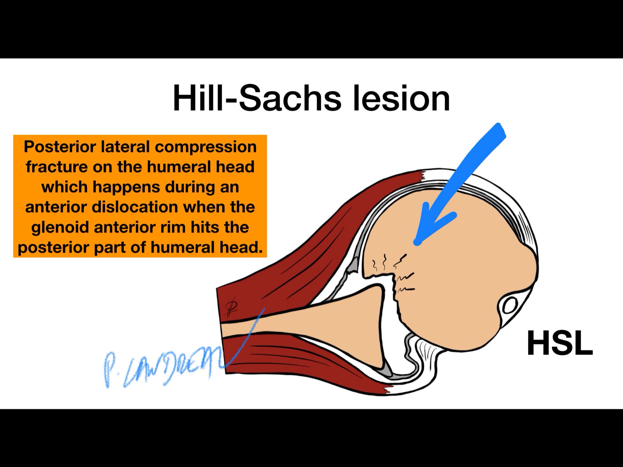 Hill  meaning of Hill 