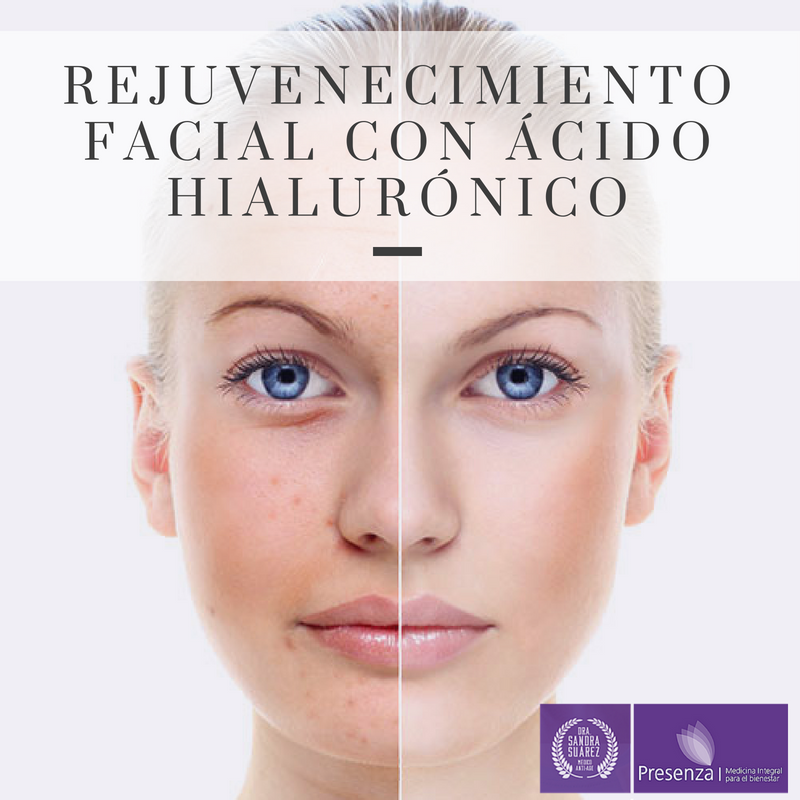 PresenzaClinica's tweet photo. #FelizMiércoles El rejuvenecimiento facial con #ÁcidoHialurónico está al alcance de tus manos. ¡Conoce más! ▶️▶️ https://t.co/b7SLGTUvsf https://t.co/OV0FJKFCbJ