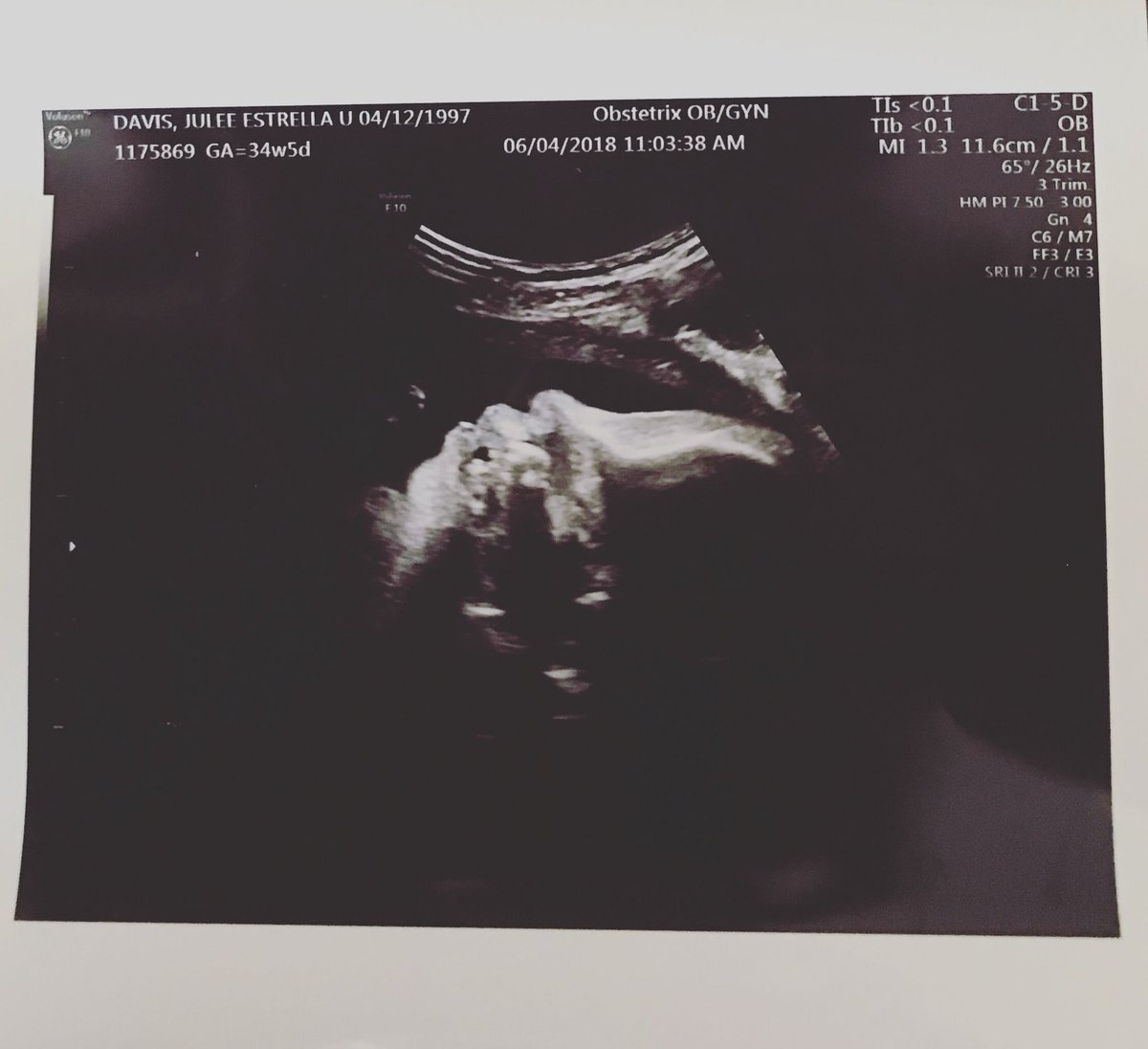 julee_143's tweet photo. Cant wait to meet you baby boy 💙 Any day now.. #35weeks 🙏🏼 https://t.co/KDPruk4W9E