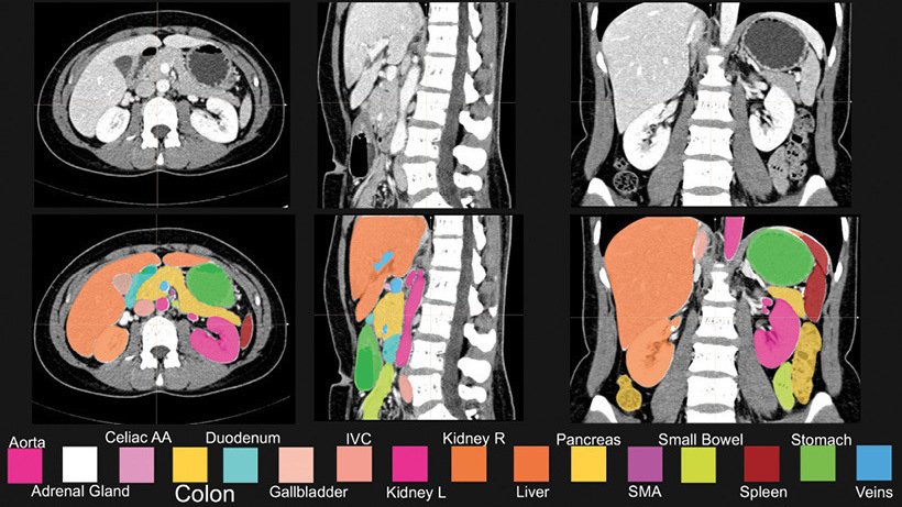 thisisadamo's tweet photo. Now this is a good example of #AI.  "Helping doctors in their jobs."  "Assist doctors in diagnosing strokes."  Key words: 'help' and 'assist'.  https://t.co/Wn6U4oWIkk https://t.co/ozhf8pFPAS