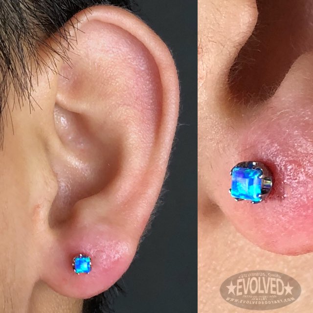 EvolvedBodyArt's tweet photo. #Lobe piercing by Nick at #2520SummitSt. Featuring @ANATOMETAL. #safepiercing #evolvedbodyart #anatometal #lobepiercing https://t.co/8VoFn2Mgs1