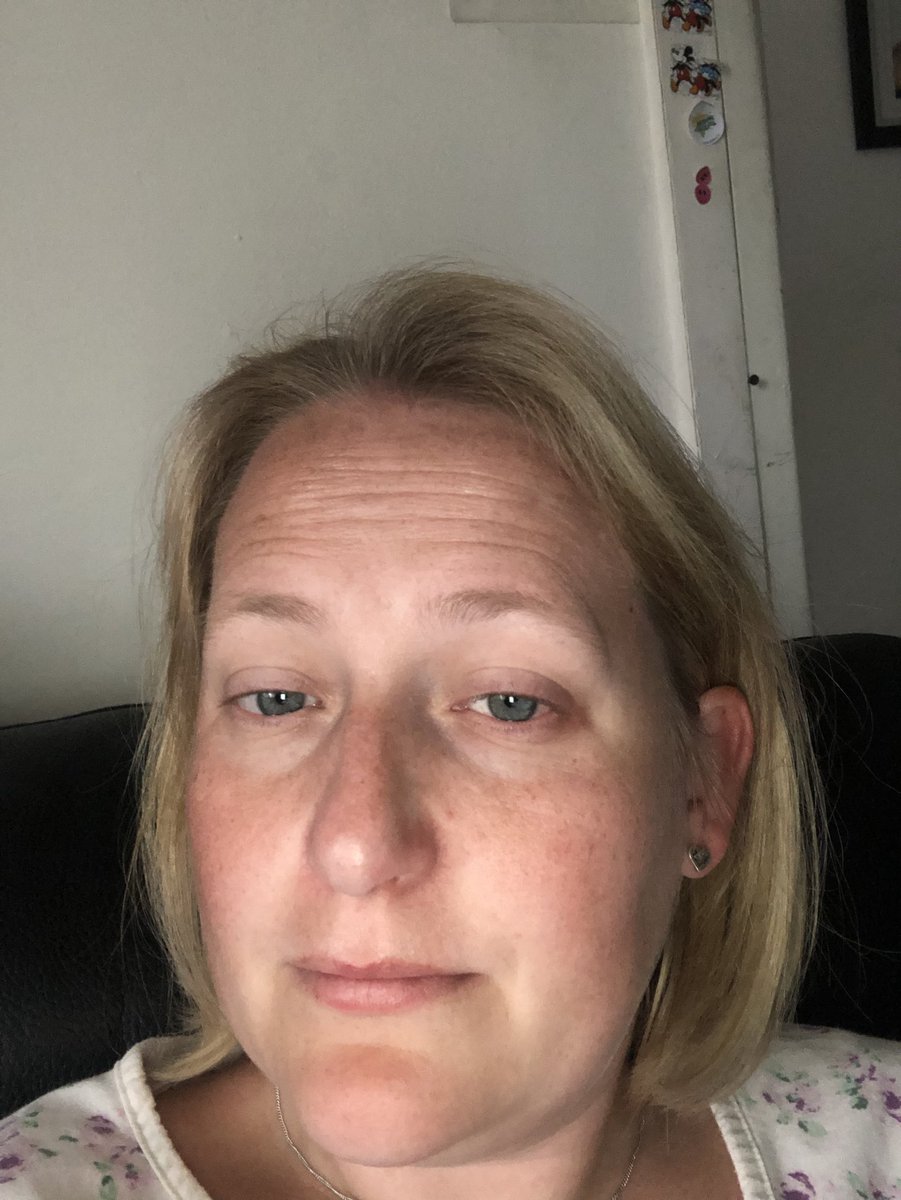 evansclaire1984's tweet photo. The state of me due to hayfever... not a happy bunny, nose streaming, eyes itching, headache and exhausted:-( #hayfever #hatepollen https://t.co/lrp63HauH5