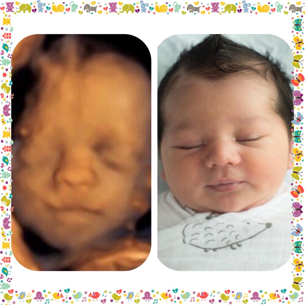 baby_dimensions's tweet photo. Beautiful side-by-side image have a #baby that we did. Love it my mom send in there after image when they came to us. Makes an #awesome display in the babies nursery. All about #3d and #highdefinitionimagines at its best. #babydimensions https://t.co/s7YBx9Kctk