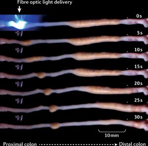 NatRevGastroHep's tweet photo. New NRGH #ResearchHighlight | An exciting new study demonstrates that #optogenetic control of #ENS activity can evoke contractions of the #colon to aid motility in vitro, as well as in vivo using using wireless technologies. Read more here: £ https://t.co/SytyIAuxlh https://t.co/Ti1LY8T7sG