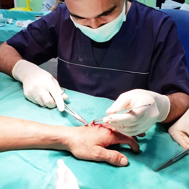 azri5828's tweet photo. Susahhh surgery kat tangan ni.. vessel sepah2 sana sini. https://t.co/tZWHmLajlc