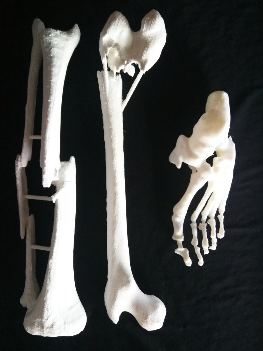 MM3D_'s tweet photo. #impresión3d de huesos para #curso de #traumatologia
#traumatology #course with #3DPrinting #bones
#impressio3d d'ossos per curs de #traumatologia
#medicalmodel3d #medicaldevice #huesos #planificaciónquirúrgica #surgeryplanning #trainning https://t.co/a8sc3IurEj