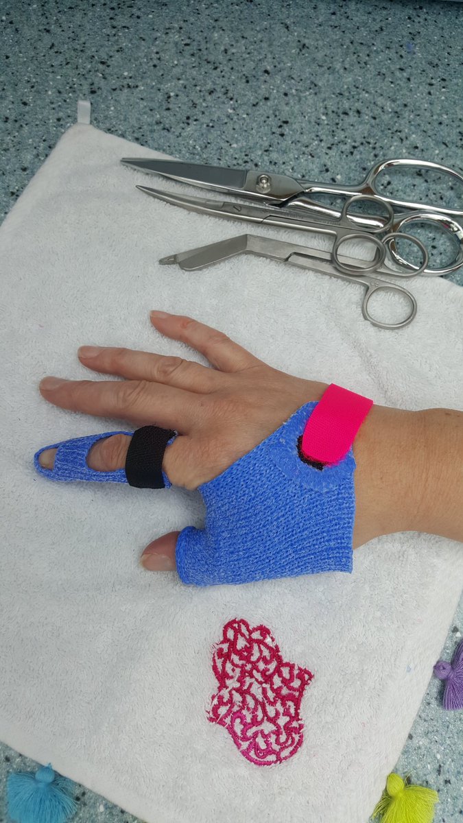 N0RHAND's tweet photo. @N0RHAND had a great morning expanding their splinting skills with @Promedics new thermoplastic material! #ORFICAST #handtherapy @leannemiller247 https://t.co/NLZTVo9OHp