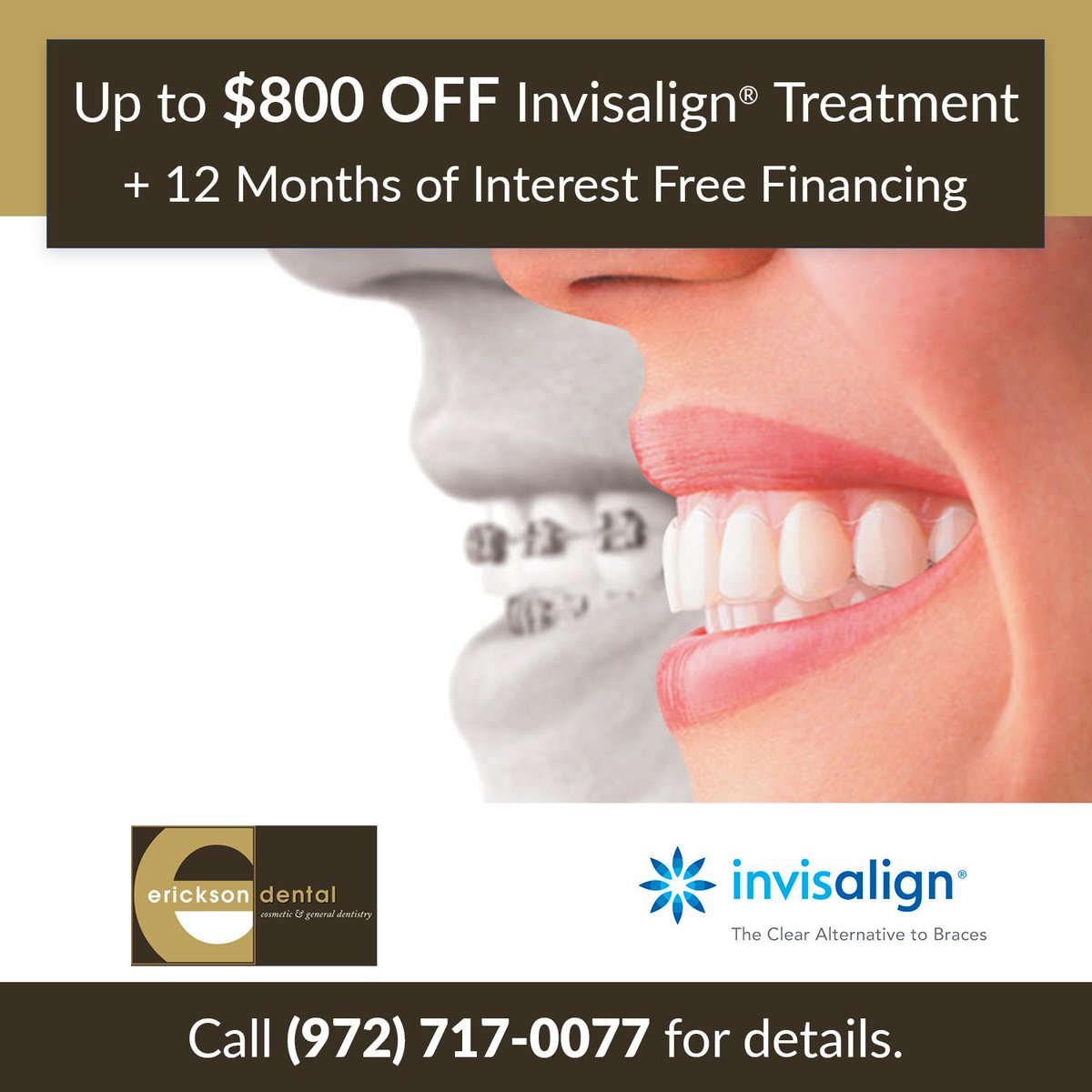 DrJasonErickson's tweet photo. For a limited time, Erickson Dental is offering up to $800 Off Invisalign Treatment with 12 months of interest-free financing.  We also offer free teeth whitening with all Invisalign treatments.  Call (972) 717-0077 to schedule an appointment with Dr. Erickson today! https://t.co/83j65glTQg