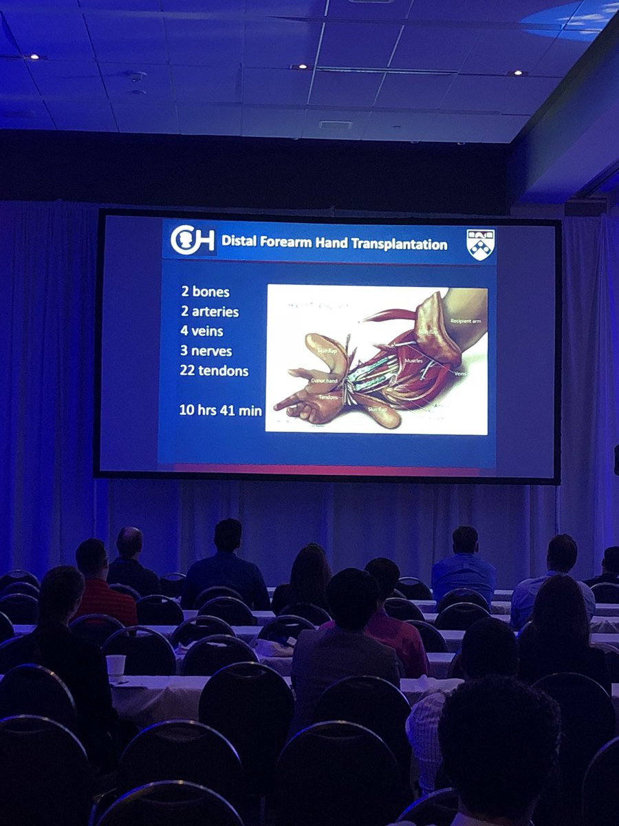 MaterialiseNV's tweet photo. Benjamin Chang, MD, FACS of @ChildrensPhila is at #MaterialiseExperience discussing our partnership to complete a successful double hand transplant for a wonderful 6 year old boy. 

#3DPrinting and #3DGuides were essential to preparing and operating. https://t.co/hNn6N9vumP