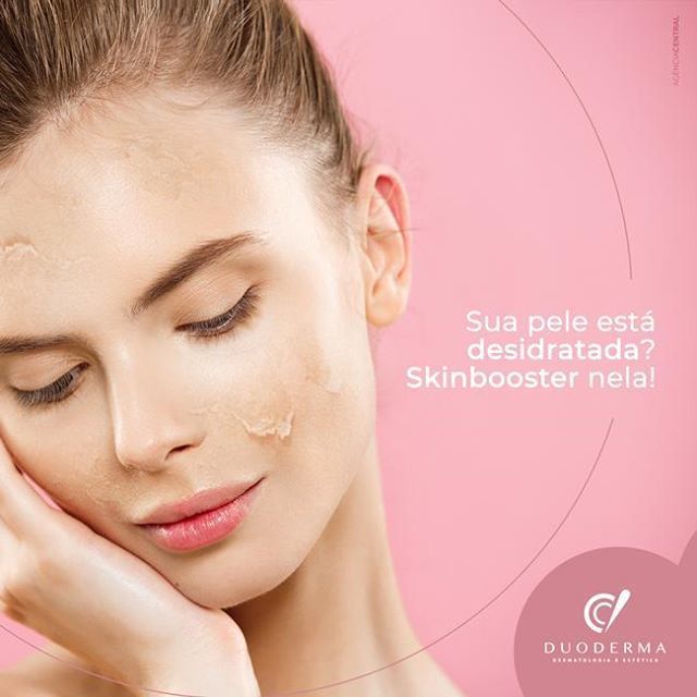 duoderma's tweet photo. Skinbooster é uma técnica consiste na injeção ácido hialurônico de baixa concentração em diversos pontos da pele com objetivo de hidratá-la
imediatamente de forma profunda e uniforme, o que faz com que essa pele fique mais lisa, além de estimular a produ… https://t.co/CnJlbz4uAz https://t.co/1mMKwTmEQZ