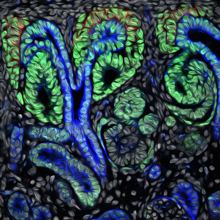 CIRMnews's tweet image. Be on time! Scientists at @uscstemcell show that cell identity in #kidneydevelopment is highly influenced by timing. Study in @Dev_Cell bit.ly/2kVHwS6