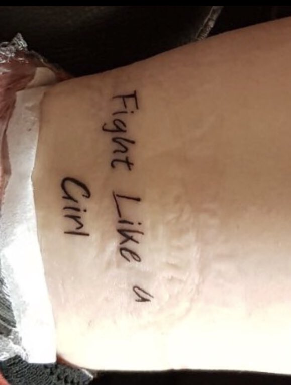 SHIELDStats's tweet image. Hey @chloebennet! Sorry to hear that you’re hurt &amp;amp; can’t make the comic con in Paris. Your health is extremely important, &amp;amp; I sincerely hope you get well soon and have a healthy recovery. 

Remember why I got this tattoo, fight like a girl and stay strong 

From - @GlitterQuake