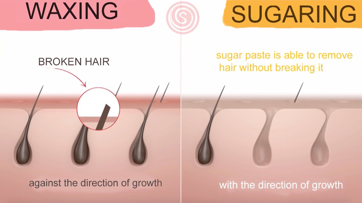 Sugaring Nyc On Twitter With Sugaring Technique You Remove The