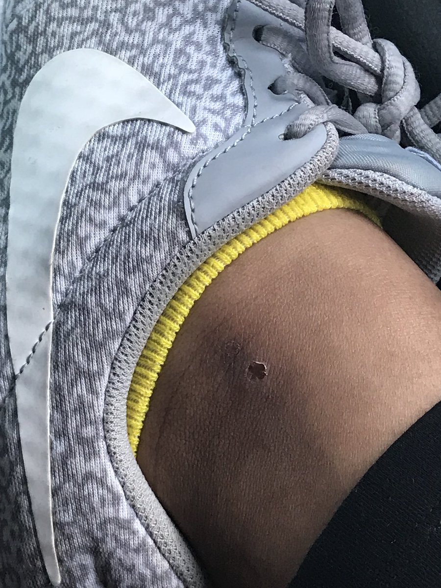 ace__deuce's tweet image. #softballproblems cleating your own ankles 😩🙄
