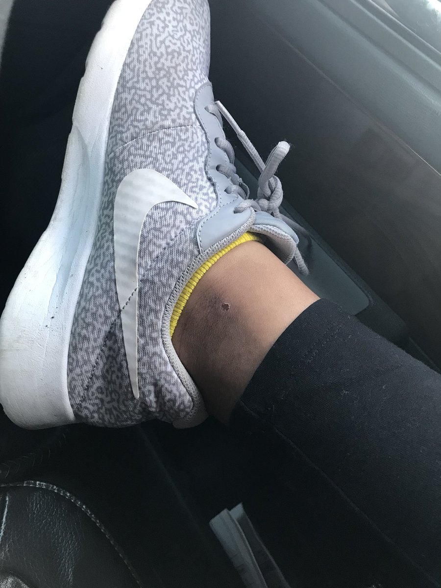 ace__deuce's tweet image. #softballproblems cleating your own ankles 😩🙄