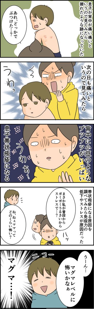 続きはブログへどうぞ 天使な小悪魔たち : 息子帯状疱疹にかかる https://t.co/lmPZJ7Z9oH 