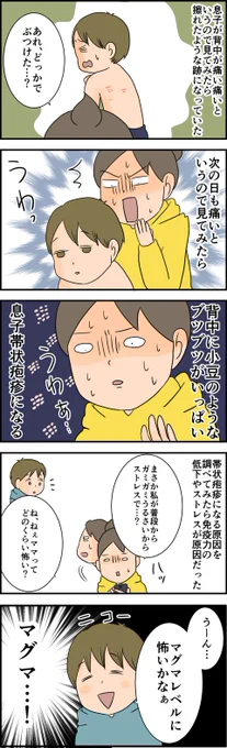 続きはブログへどうぞ 天使な小悪魔たち : 息子帯状疱疹にかかる https://t.co/lmPZJ7Z9oH 