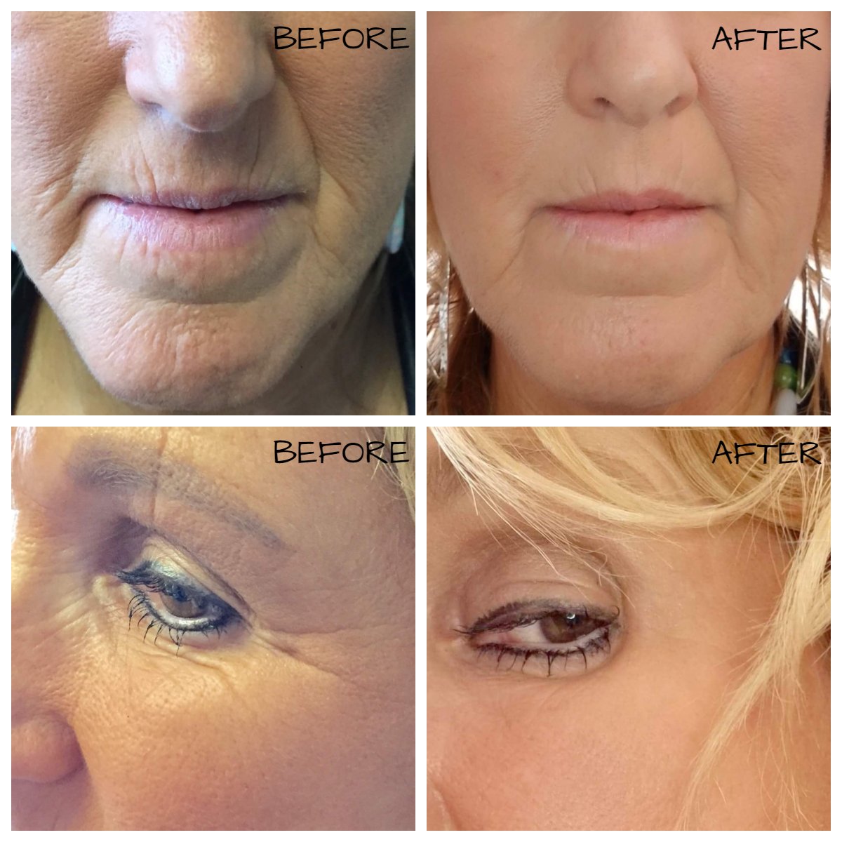 SpaNanaimo's tweet photo. Using my new JL Skincare products daily, you will see a difference in the appearance and texture of your skin within a couple of days and more improvements with continued use - see the difference after 4 weeks of use here! Call or visit the spa to try my new JL Skincare Line! https://t.co/RYUYgoiGTt
