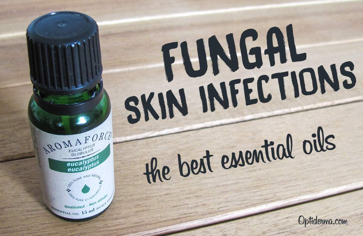 optiderma's tweet image. What are the Best Antifungal Essential Oils ? sumo.ly/V9Nv via @optiderma