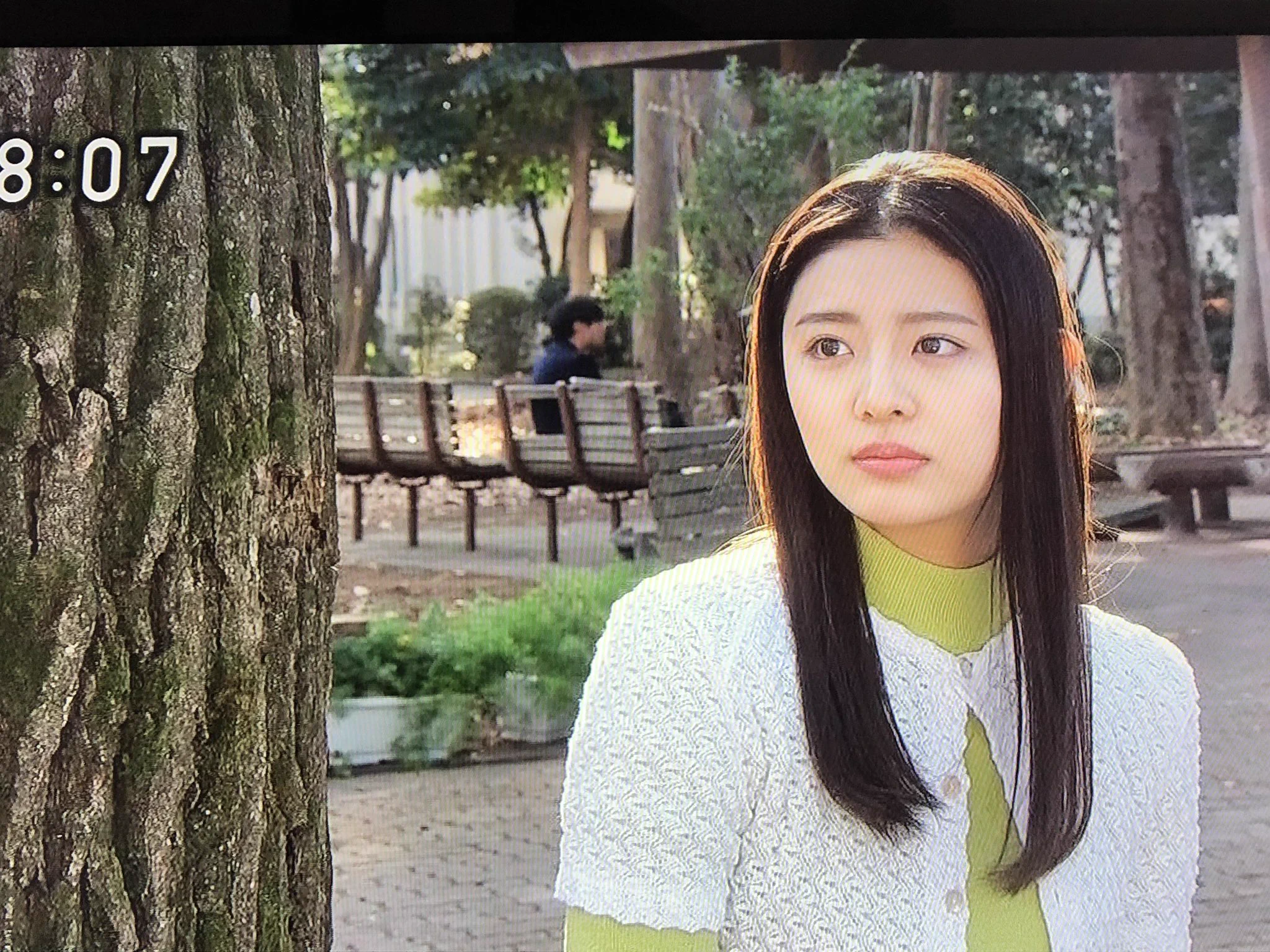 古畑 星 夏 整形