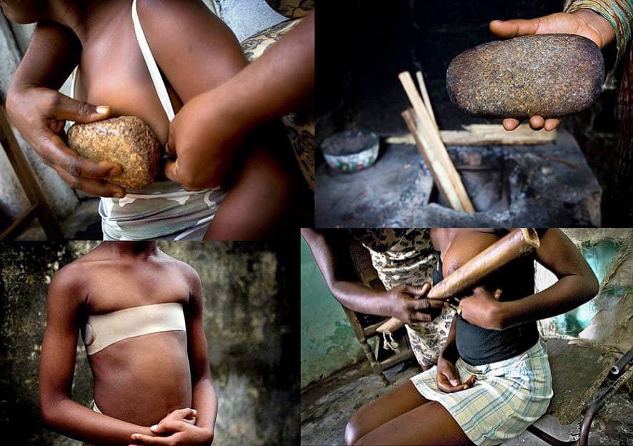 Discussing An Under-reported Torture To Girls – Breast Ironing olotufunke.com/discussing-an-…