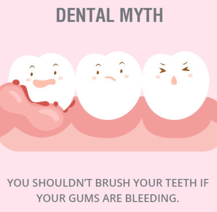 TeethSolutions's tweet image. Gums bleed due to inflammation caused by leaving plaque on the teeth. Brushing and flossing twice a day is the best way to help gums heal. #funfactfriday
