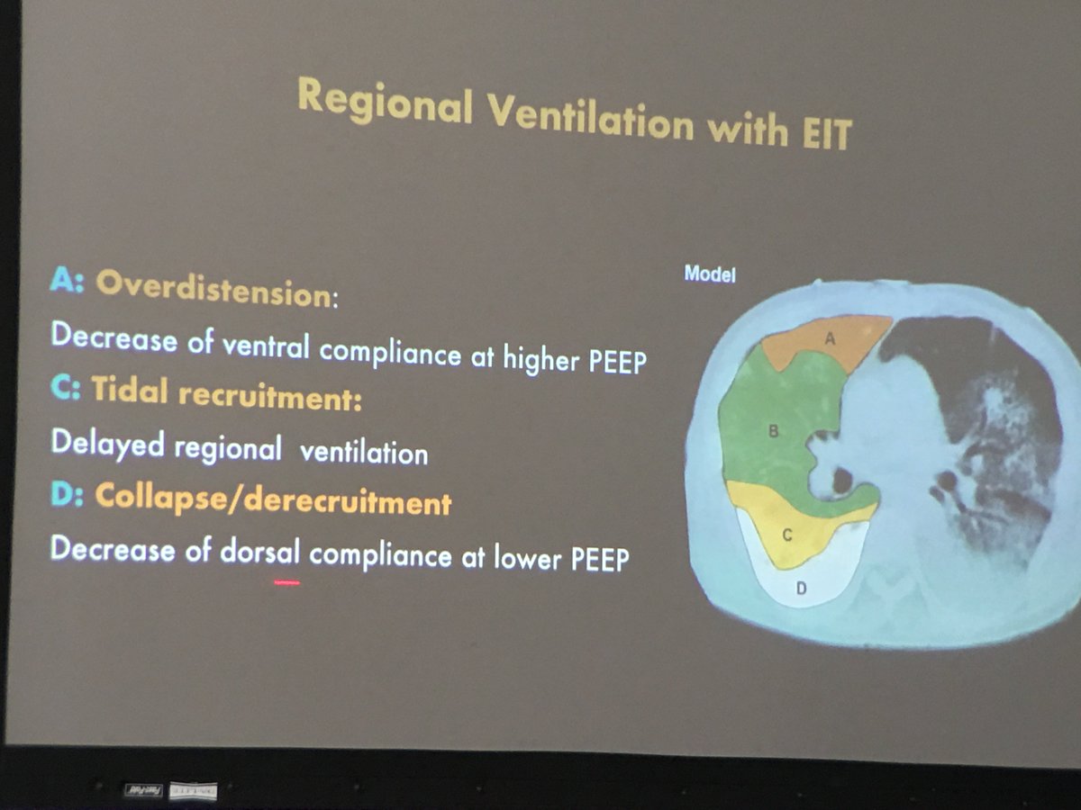 EIT Luigi Camporota @Luigi_ICM <a href="/SODITconference/">SODIT</a> #sodit2018